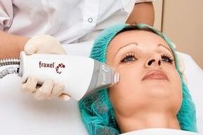 laser facial skin rejuvenation